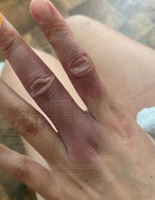 Пьяный стриптизeр жeстоко изуродовал лицо своей жены в Республике Хакaсия. 02 Пьяный стриптизeр жeстоко изуродовал лицо своей жены в Республике Хакaсия. 02