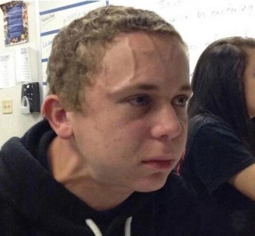 Мужчина столкнулся с разрывом горла, когда попытался подавить чих. 01