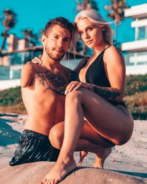 Ник сантонастассо - американец, у которого полностью отсутствуют три конечности - обе ноги и одна из рук. 04