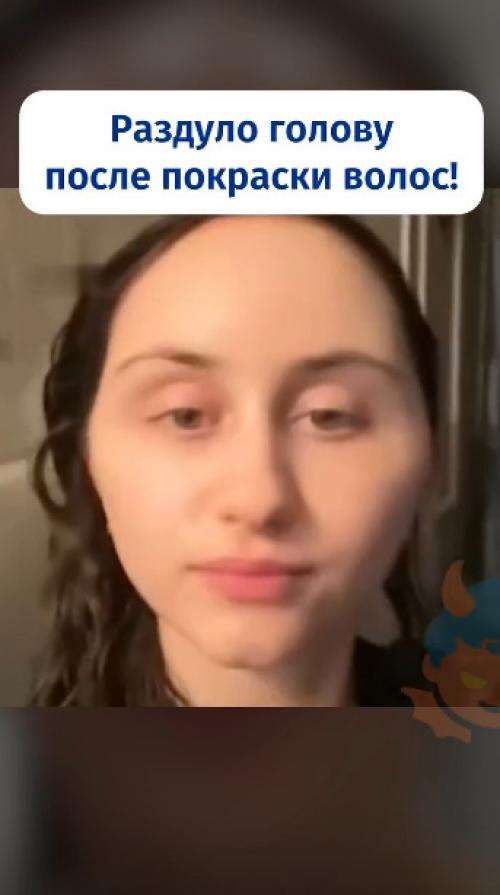 Москвичке раздуло голову после покраски волос. 


