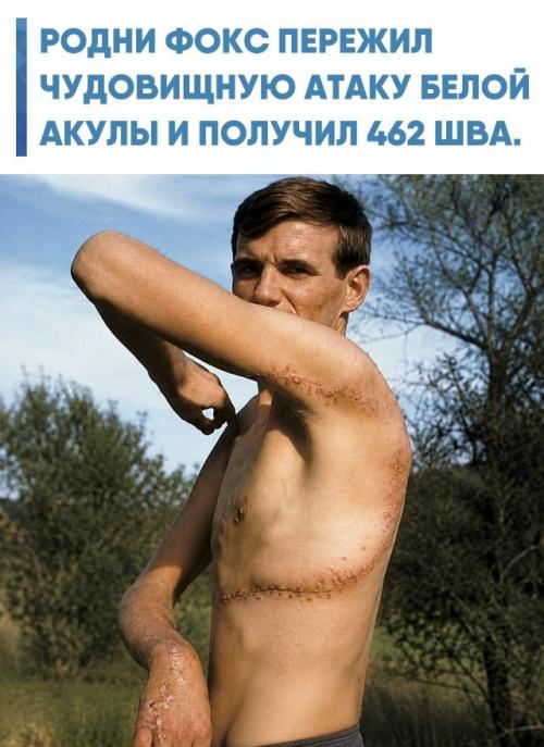 В 1963 году во время соревнований по подводной охоте в южной Австралии на 23-летнего Фокса напала большая белая акула.  
